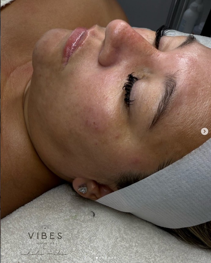 After facial - smoother, more even skin